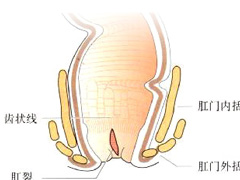 福州医博肛泰肛肠医院预约挂号