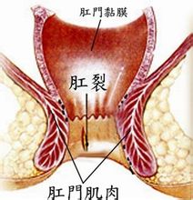 福州医博肛泰肛肠医院预约挂号