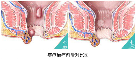 福州医博肛泰肛肠医院预约挂号