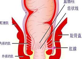 福州肛肠医院 肛门损伤     2,感染流脓:肛瘘感染发炎后,肛门疼痛剧烈