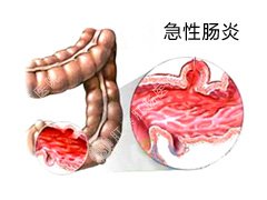 福州医博肛泰肛肠医院预约挂号