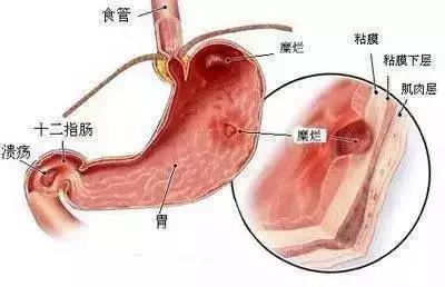 福州医博肛泰肛肠医院预约挂号